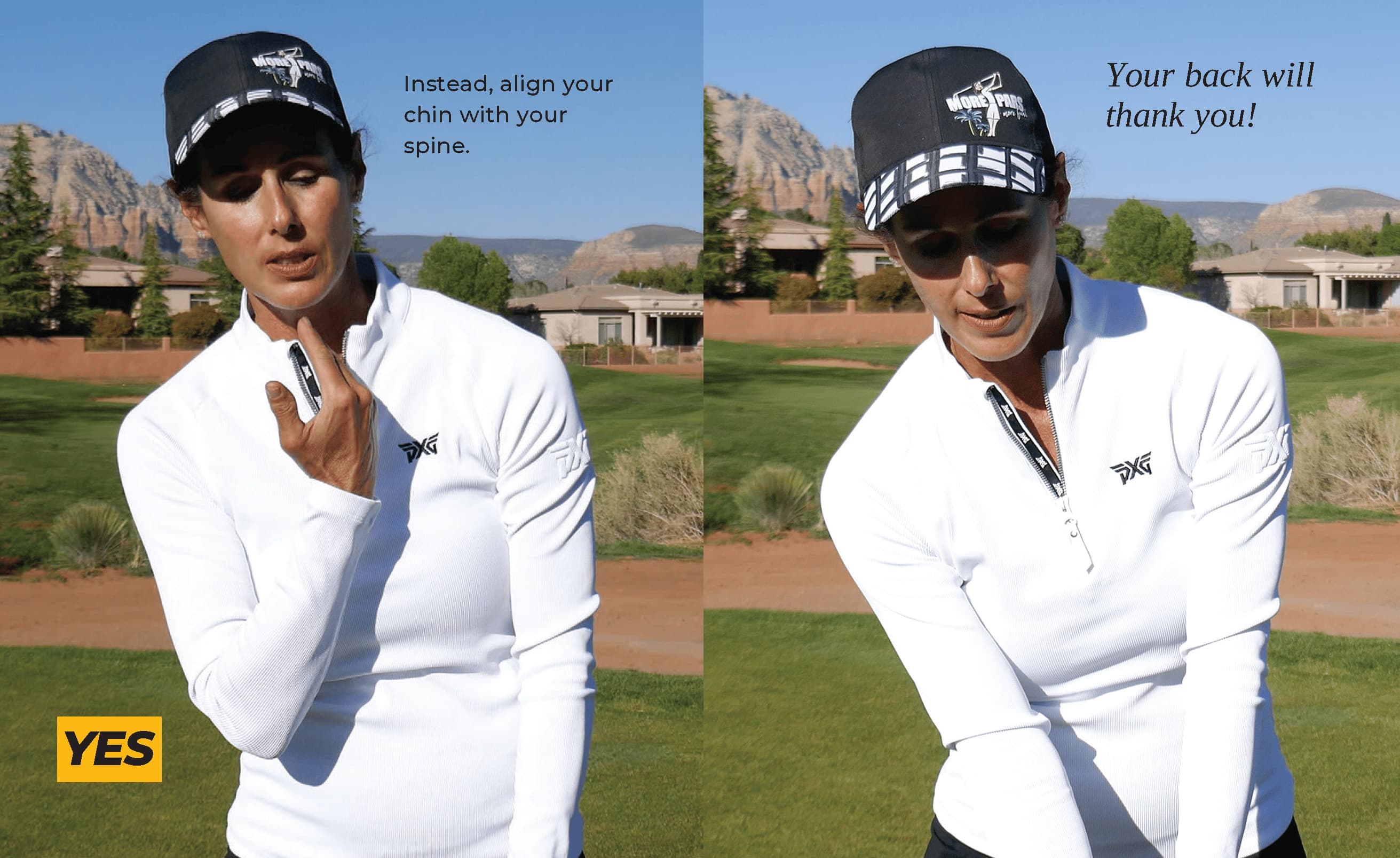 Chin at Setup in Line