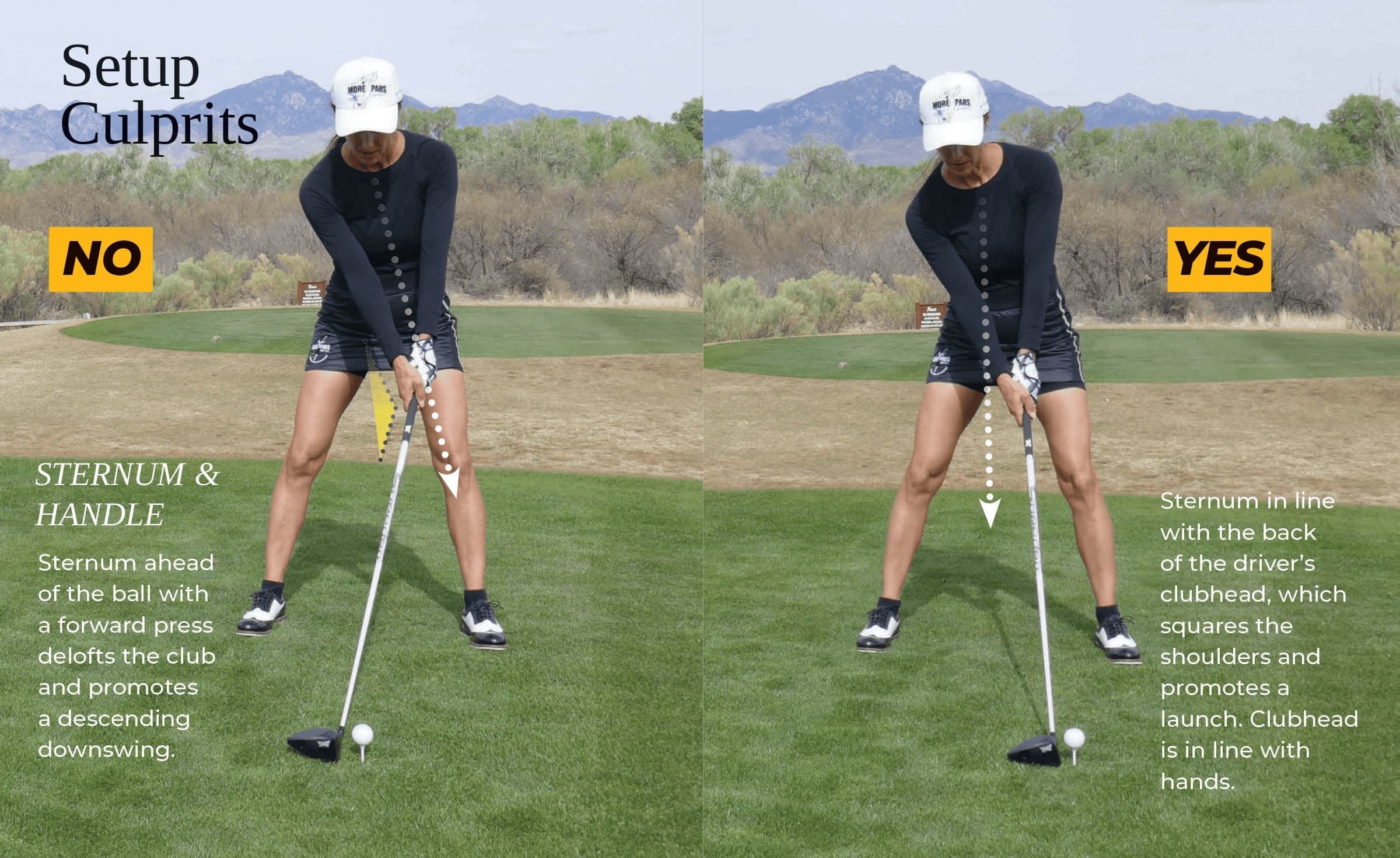 Driver Setup Sternum Culprits