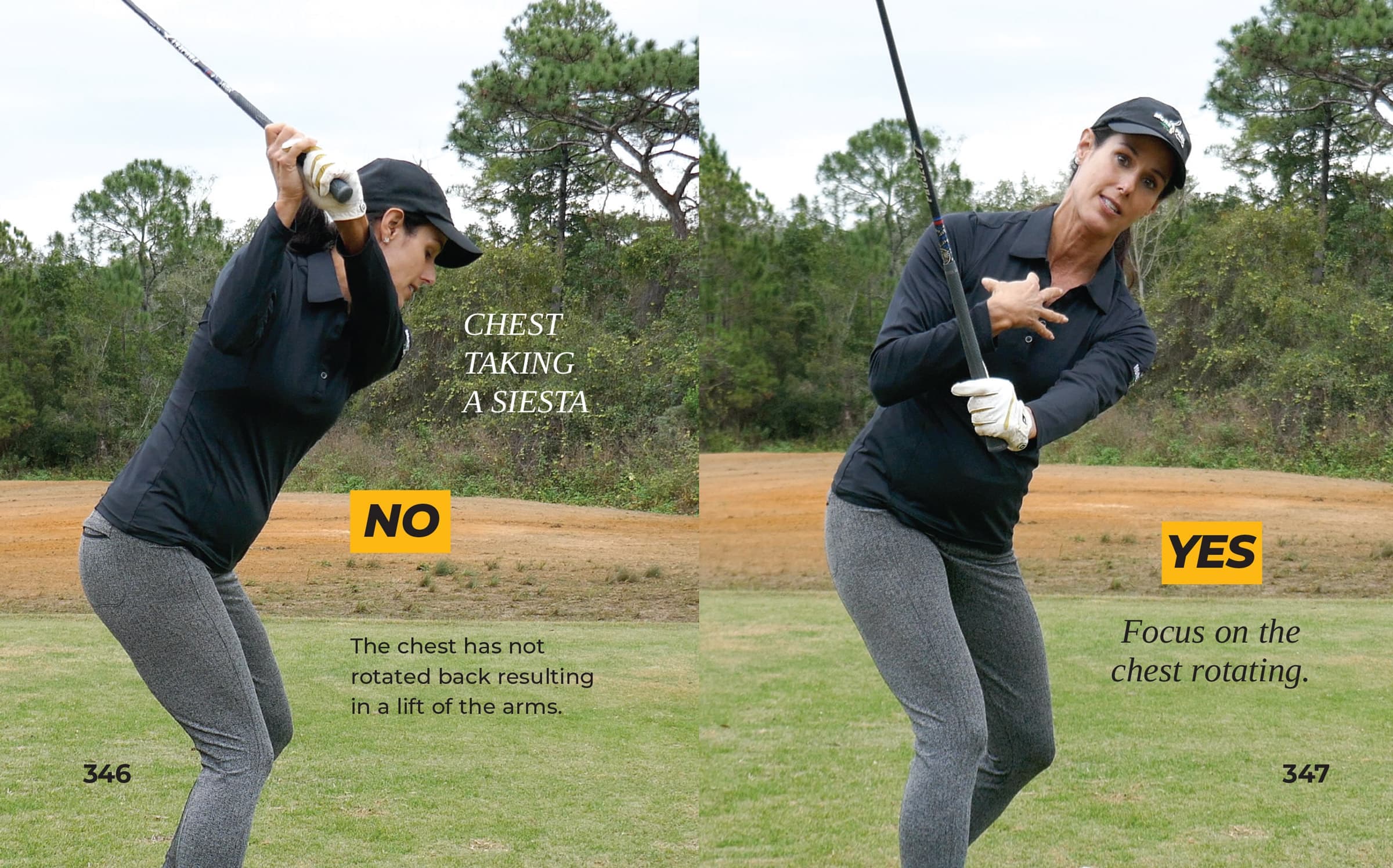 Excessive Forearm Rotation 1